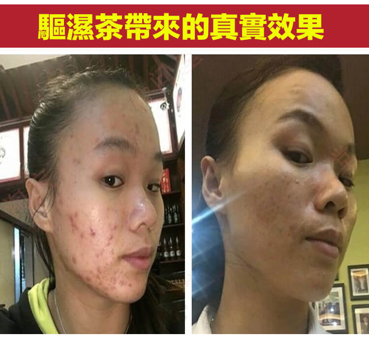 華祖拾遺驅濕茶